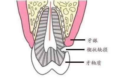 深圳牙科醫院，<a href='/' target='_blank'><u>深圳善貝口腔</u></a>